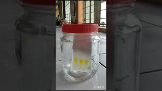 Thin Layer Chromatography of Curcumin [upl. by Mavilia]