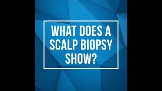 Scalp Biopsies  Dr Donovans Overview in 10 Minutes [upl. by Ternan611]