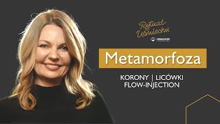 Konkursowa metamorfoza Ani  Medicover Stomatologia [upl. by Norrek]