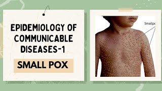 SMALL POX  VARIOLA EPIDEMIOLOGY OF COMMUNICABLEDISEASES1 [upl. by Ydnic]