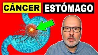 SÍNTOMAS PELIGROSOS DE CÁNCER ESTÓMAGO GÁSTRICO 💥 Causas Prevención y Tratamiento [upl. by Ennoved]