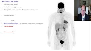 What does a PET scan look like [upl. by Panayiotis]