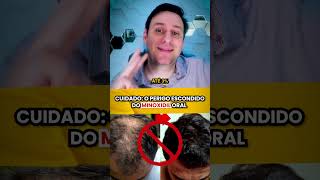 CUIDADO os perigos do MINOXIDIL ORAL [upl. by Garnet]