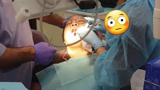 Odontectomy Procedure Wisdom Tooth [upl. by Ahtinak]