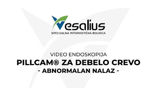 VESALIUS  PillCam® za debelo crevo Abnormalan nalaz Animacija [upl. by Silver923]