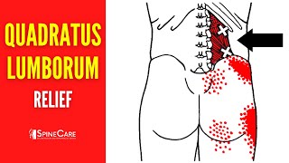 How to Fix Quadratus Lumborum Pain FOR GOOD [upl. by Mcgill]