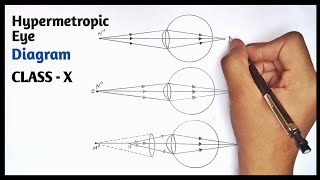 How to Draw Hypermetropic Eye  Easily Step by Step theartofcourse [upl. by Pogue]