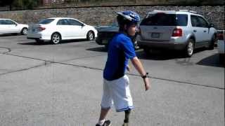 Skateboarding with Prosthetic Leg [upl. by Nnyw374]