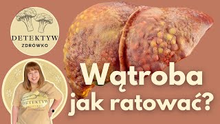 Wątroba  jak ją ratować [upl. by Akeimat]