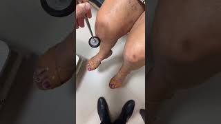 What is your diagnosis medical doctor kneejoint hindu usa viralvideo shorts physiocare [upl. by Ymmij]