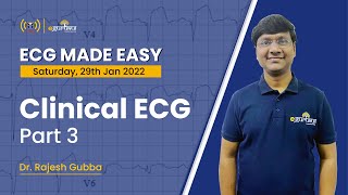 ECG Made Easy  Clinical ECG Part 3  Dr Rajesh Gubba  DBMCI  eGurukul [upl. by Forrest]