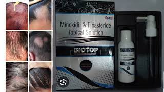 BIOTOP Topical Solution Minoxidil amp Finasteride Topical Solution [upl. by Minnnie961]