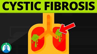 Cystic Fibrosis Medical Definition  Quick Explainer Video [upl. by Hobbs]