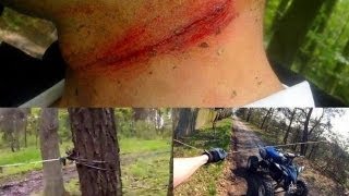 Miese SEILFALLEN gegen Radfahrer und Quads  Kugelsichere Rucksäcke  DANKE [upl. by Aerdnat53]