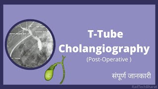 TTube Cholangiography Radiology in Hindi [upl. by Issie]