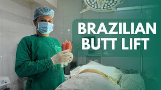 Brazilian Butt Lift  BBL  Buttock Enlargement  Butt Lift  Fat Transfer  Body Shaping [upl. by Nemracledairam37]