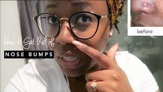 HOW TO GET RID OF A NOSE PIERCING BUMP KELOID FAST  hellotinashe [upl. by Osyth]