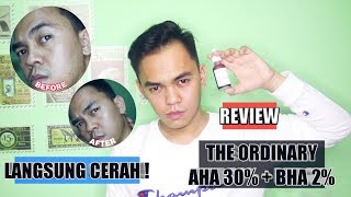 THE ORDINARY AHA 30 BHA 2 PEELING SOLUTION REVIEW  MASKER TERBAIK BUAT KOMEDO amp JERAWAT [upl. by Schnabel]