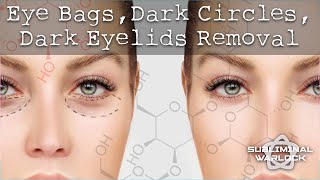 Remove Eye Bags Dark Circles Sunken Eyes and Dark Eye Lids Very Effective 100 [upl. by Nyrhtakyram675]