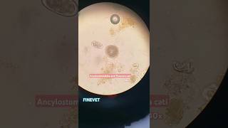 Ancylostomatidae and Toxocara cati hookworm roundworm cat microscope lab ancylostoma toxocara [upl. by Ennoirb]