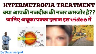 HYPERMETROPIA TREATMENT नजदीक की नजर कमजोर होना [upl. by Ebaj]