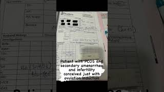 patient with pcos and secondary amnorrhea conceived just with ovulation induction [upl. by Eissak]