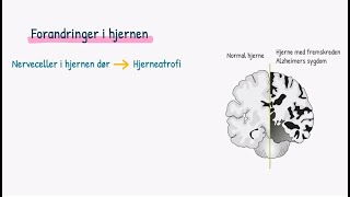 Nervesystemet Demens [upl. by Schott]