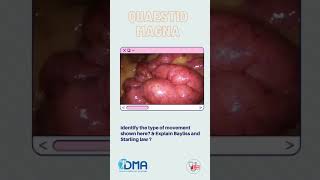 Intestinal peristalsis  OSPE amp OSCE  MBBS  NEXT  PLAB  USMLE [upl. by Zildjian391]