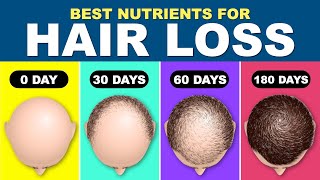 Hair fall Treatment  Hair Loss Treatment for Men  How to stop hair fall  Hair RegrowthNUTRIENTS [upl. by Wendolyn]