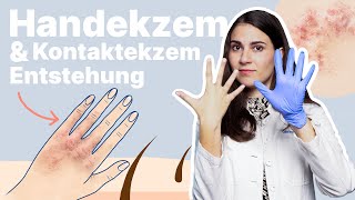 Hände trocken und rissig  was tun Ärztin erklärt 👋 [upl. by Rafael]