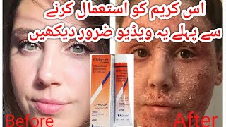 Clobevate cream for whiteningclobevate creamclobevate cream for hands whiteningside effects Urdu [upl. by Sawyor723]