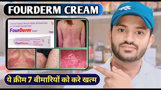 Fourderm cream uses in hindi and full review [upl. by Devan]