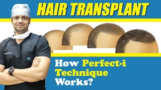 Medlinks Perfect i Hair Transplant Technique  Best Hair Transplant Technique  Dr Gaurang Krishna [upl. by Roberta248]