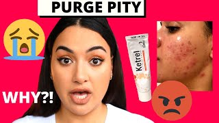 TRETINOIN CREAM RUINED MY SKIN  SURVIVING THE PURGE STAGE [upl. by Pasia]