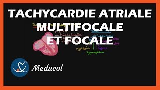 Tachycardie Atriale Multifocale et Tachycardie Atriale Focale Physiopathologie symptômes et ECG [upl. by Ahtekal]