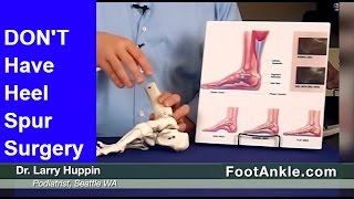 Heel Spur Treatment – How to Avoid Heel Spur Surgery  Seattle Podiatrist [upl. by Sauer134]