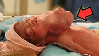 Ein Baby wird mit einem Knubbel am Hals geboren und der Arzt ist überrascht [upl. by Idnahc]