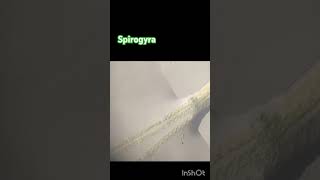 Spirogyra observation by microscope [upl. by Aerdnaxela]