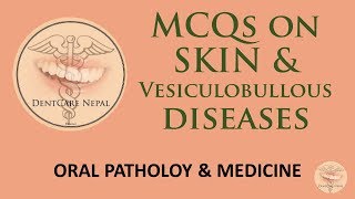 MCQs on Skin and Vesiculobullous Diseases  Oral Patholody and Medicine [upl. by Tillio]