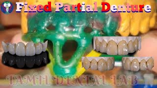 Dental Lab Work  Ceramic Teeth  Fixed Partial Denture  All Stage Short Video  Tamil Dental Lab 🦷 [upl. by Eehsar544]