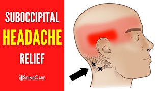 How to Release Tight Suboccipital Muscles  HEADACHE RELIEF in Seconds [upl. by Kinna]