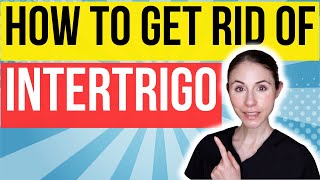 How To Get Rid Of Intertrigo FAST  Dermatologist Tips [upl. by Chellman]