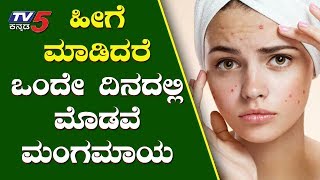 ಒಂದೇ ದಿನದಲ್ಲ ಮೊಡವೆ ಮಂಗಮಾಯ  Pimple Removal Tips  Kannada Health Tips  TV5 Kannada [upl. by Cochran]