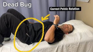 Dead Bug  Correct Pelvic Rotation [upl. by Leirbag577]