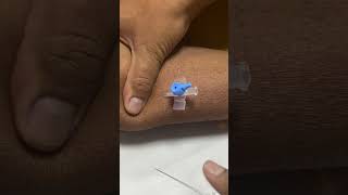 IV cannula insertiondocternursingmotivationviralvideoshortvideo [upl. by Tronna]