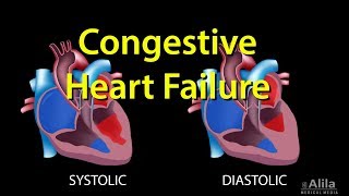 Congestive Heart Failure Leftsided vs Rightsided Systolic vs Diastolic Animation [upl. by Abibah]