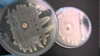 BIO 2192 UNIT 12  Susceptibility to Antibiotics  Novobiocin Sensitivity [upl. by Duwad]