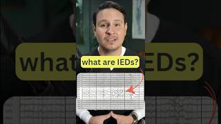 Interictal Epileptiform Discharges on EEG eeg neuroscience epilepsy neurology seizures [upl. by Rebna]