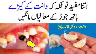 Danton Ke Keedon Ka Asan Totka  Remove Cavity From Teeth  Dant Ka KeeRay Ka Ilaj  Toothache [upl. by Pearl]