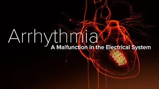 Heart Arrhythmia – Yale Medicine Explains [upl. by Briant697]